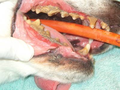 Severe Dental Disease