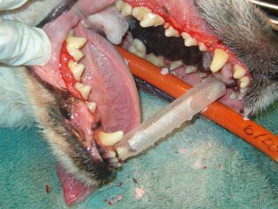 Severe Dental Disease